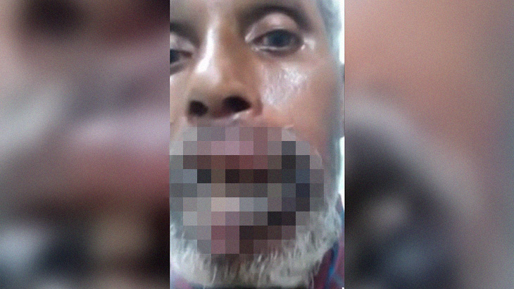 【閲覧注意】口が腐って溶けてしまった男のグロ動画。一体なぜ･･･。