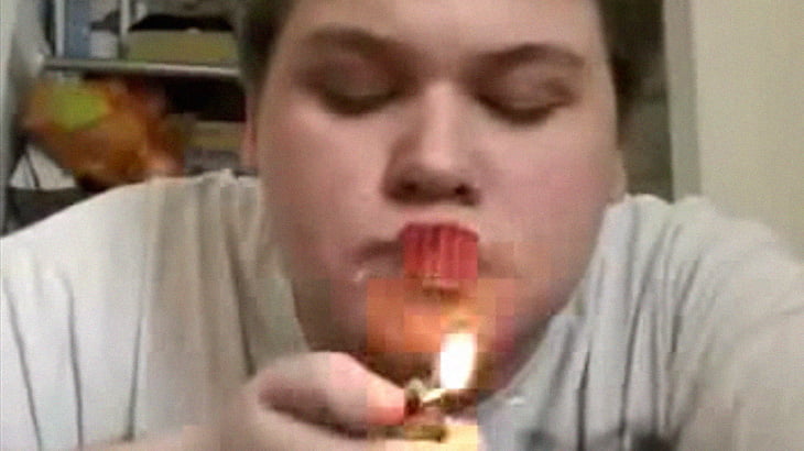 【閲覧注意】イカれ男さん「口に爆竹くわえて爆発させてみるわｗｗ」→ 唇デロデロ･･･。