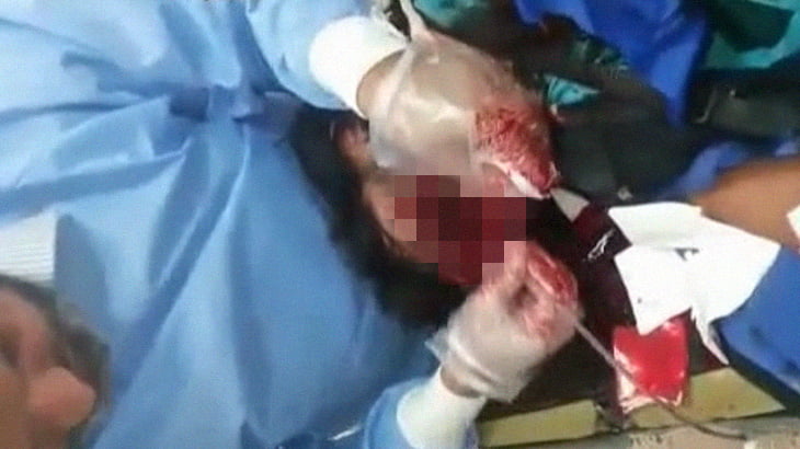 【閲覧注意】顔を爆弾で吹き飛ばされてしまった男性を手術するグロ動画。