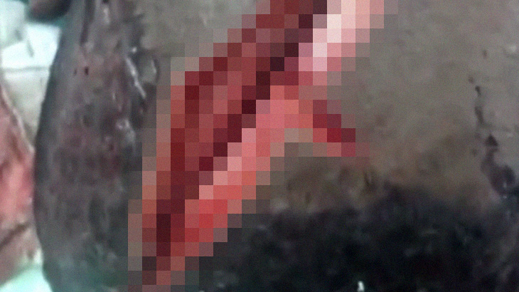 【閲覧注意】頭をマチェーテで切られた男、頭蓋骨まで割れてしまったグロ動画。