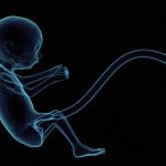 【衝撃画像】これが人間の赤ちゃんだって信じられる･･･？