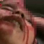 【超！閲覧注意】爆撃で頭を吹き飛ばされてしまった女性のグロ動画。