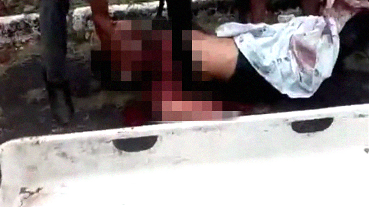 【閲覧注意】バイク事故で “肩から腕が取れてしまった” 男性のグロ動画。