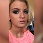 重度の「てんかん」を持つ女性の日常、1日20時間も眠ってしまう。