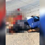 【閲覧注意】バイク事故の女性、両足切断された状態で生き延びてしまったグロ動画。