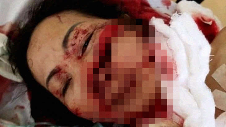 【超！閲覧注意】サイコパスの男、女性と子供をマチェーテでズタズタにしてしまう･･･。