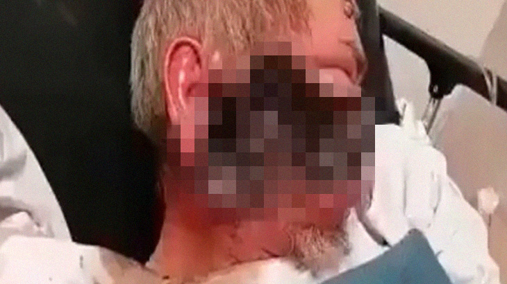 【閲覧注意】顔の半分がウジ虫に食われている男のグロ動画、これでも生きている･･･。