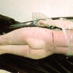 【閲覧注意】ネクロフィリア（死体愛好）にはたまらないであろう女性の死体画像集。
