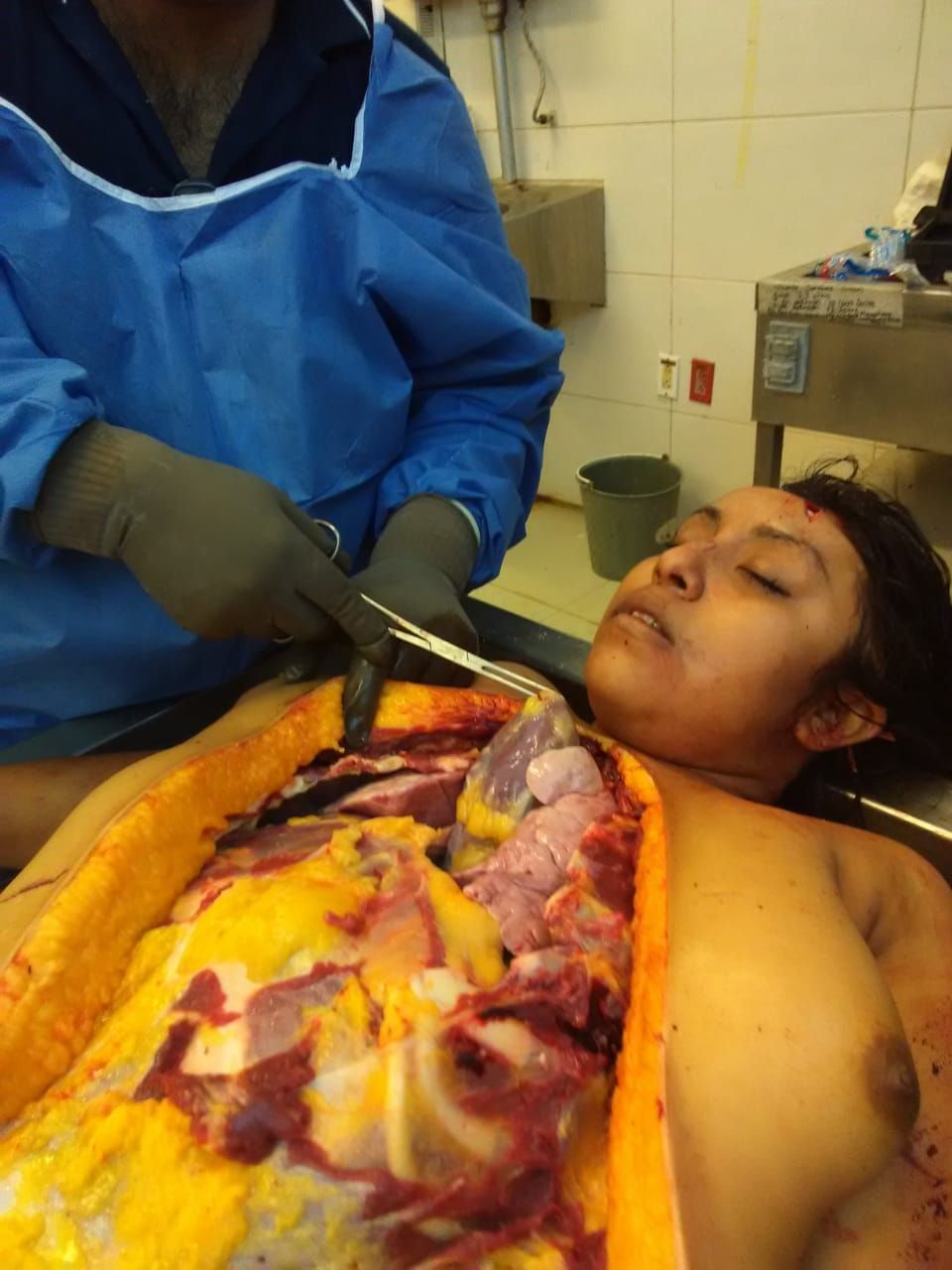 閲覧注意 女性死体の検死解剖を撮影したグロ画像 カルマニマ
