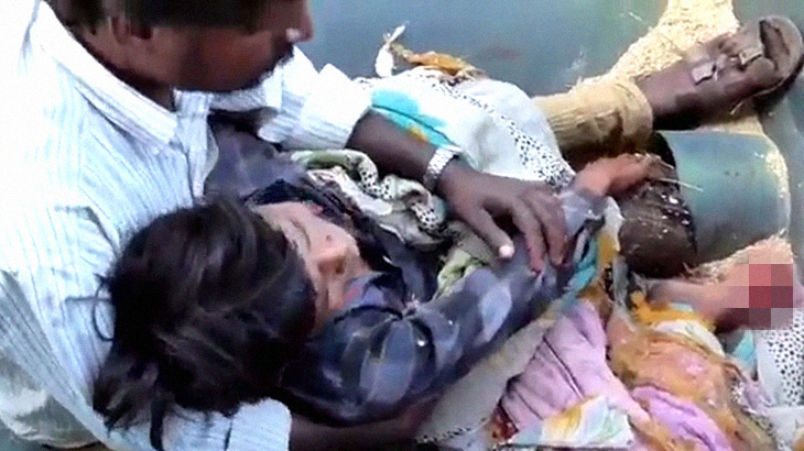 【閲覧注意】収穫機に脚を挟まれ左足を失ってしまった男の子のグロ動画。