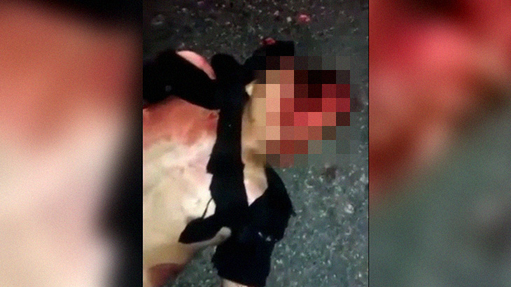 【超！閲覧注意】顔が縦に割れて脳ミソが飛び出たグロ動画。