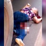 【閲覧注意】トラックに左脚を潰されてしまったおばあちゃん。