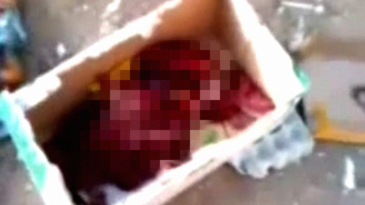 【閲覧注意】ゴミ捨て場でネズミに食われていた胎児、まだ生きている･･･。