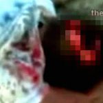 【閲覧注意】脳が飛び出てしまった男性･･･カラッポになった頭部をやたらと撮影したグロ動画。