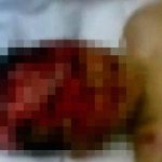 【閲覧注意】爆撃を受けて頭が割れてしまった男の子のグロ動画。