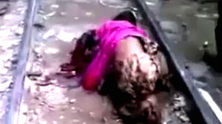 【閲覧注意】列車への飛び込み自殺に失敗した女性、両足を失う。