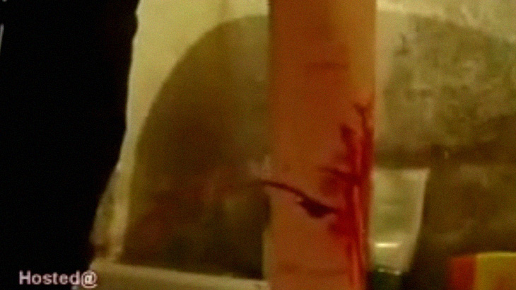 【閲覧注意】カミソリで腕を深く切る女の子。