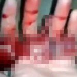 【閲覧注意】中絶された胎児。手のひらでまだ生きている衝撃映像。