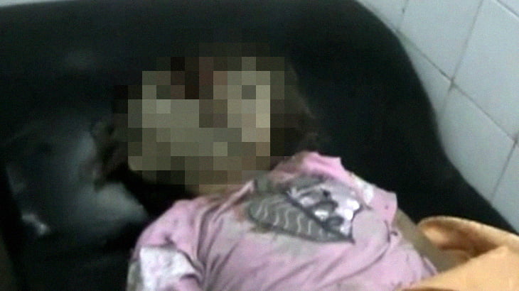 【閲覧注意】”右腕がちぎれた少年” と “顔が割れた少女” のグロ動画。