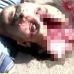 【閲覧注意】?が割れて脳がこぼれている男性のグロ動画。