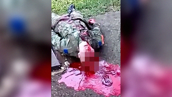 【閲覧注意】銃で自殺した兵士、頭が割れてしまったグロ動画。