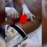 【閲覧注意】チ●コから “大量のウジ虫” が出てくるグロ動画･･･。