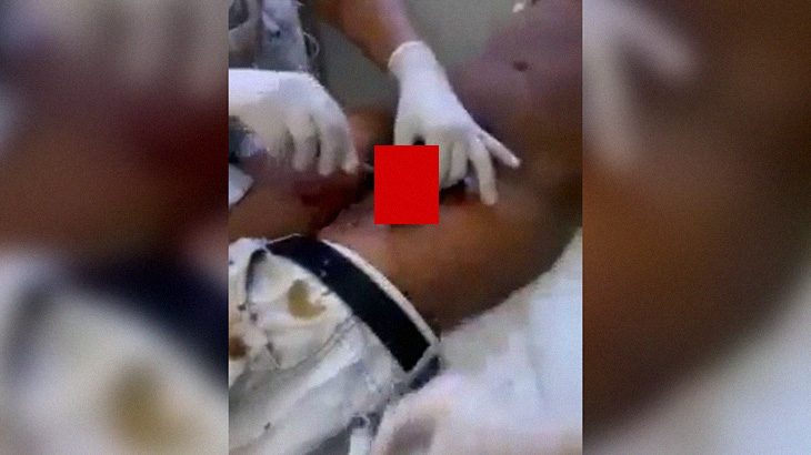 【閲覧注意】チ●コから “大量のウジ虫” が出てくるグロ動画･･･。