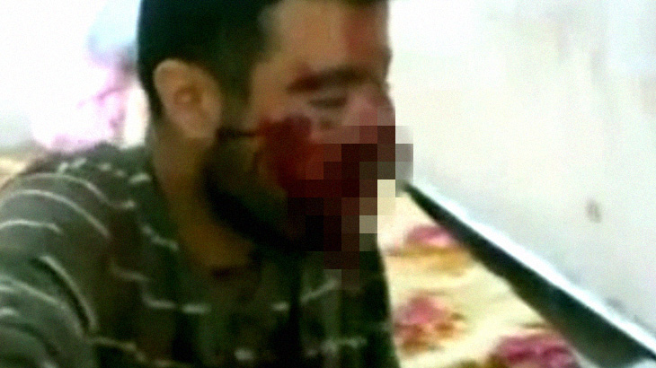 【閲覧注意】まるで “口の中が爆発” したかのような男･･･。