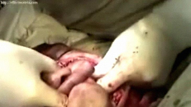 【閲覧注意】顔が “こんな状態” でも手術で元に戻せるらしい･･･。