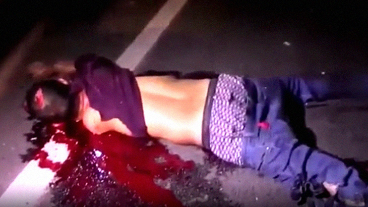 【閲覧注意】バイク事故の男性、左腕が根元から切断されてしまう･･･。