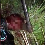 【超！閲覧注意】頭を斧で殴打される男、顔に斧が刺さってしまう･･･。