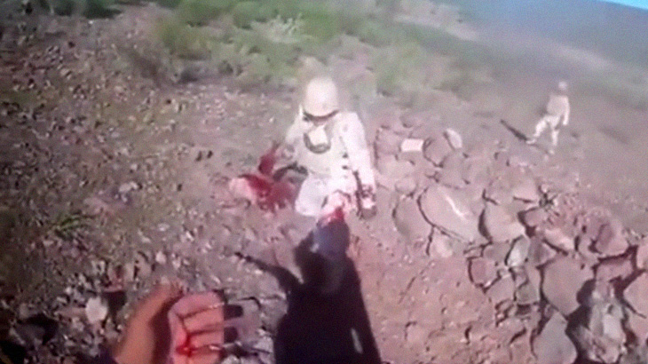 【閲覧注意】手に持った手榴弾が投げる前に爆発して “指が吹き飛ばされた” 兵士。