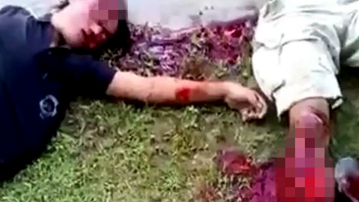 【閲覧注意】バイク事故で倒れた2人の男性、たぶんもう助からない･･･。