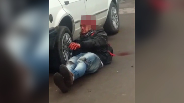 【閲覧注意】路駐していた車に衝突したバイクの男性、頭皮が剥がれてしまう･･･。