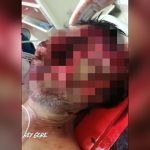 【超！閲覧注意】顔が “縦に割れて目玉が飛び出した” この男性、まだ生きてる･･･。