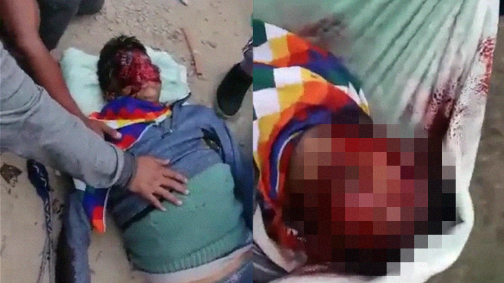 【閲覧注意】反政府デモしていた男性、”顔が崩壊” してしまう･･･。