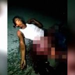 【閲覧注意】臓器が飛び出した男、まだ生きてるけどこれはもう･･･。