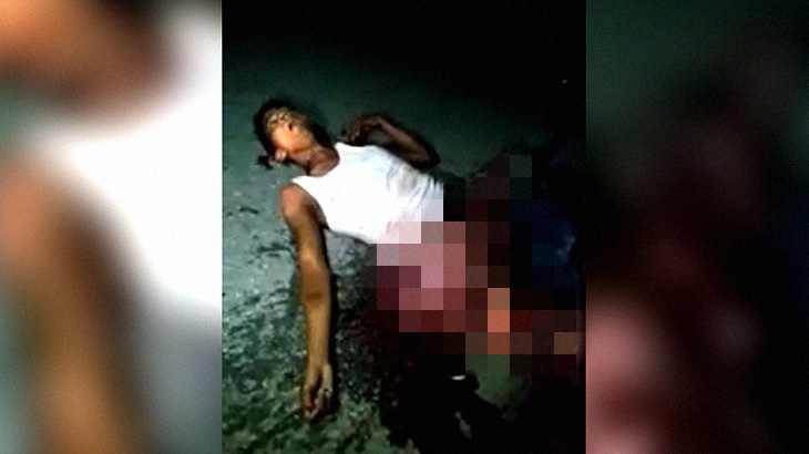 【閲覧注意】臓器が飛び出した男、まだ生きてるけどこれはもう･･･。