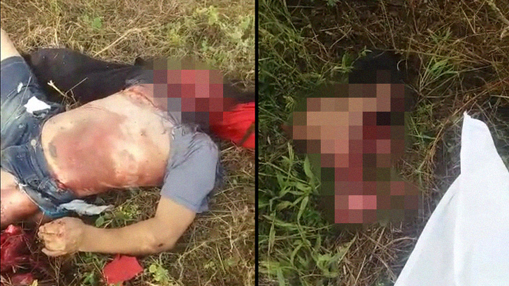 【超！閲覧注意】バイク事故の男性、顔の皮膚が剥がれてしまったグロ動画･･･。