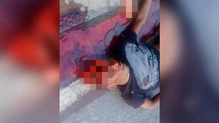 【閲覧注意】頭が割れ、脳がすべて飛び出してしまった男性･･･。