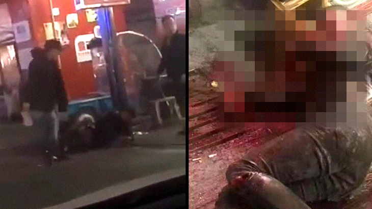 【閲覧注意】マチェーテで身体をズタズタにされてしまった男･･･。