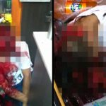 【超！閲覧注意】マチェーテで “顔をズタズタ” にされた男、もうすぐ死ぬ･･･。