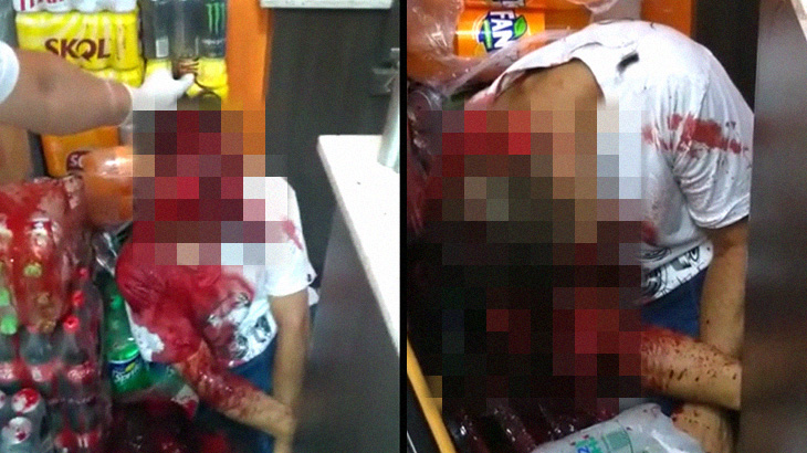 【超！閲覧注意】マチェーテで “顔をズタズタ” にされた男、もうすぐ死ぬ･･･。