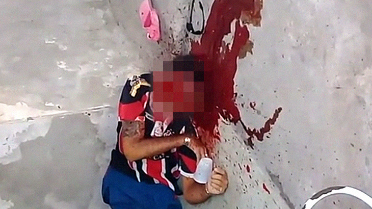 【超！閲覧注意】ショットガンで顔を撃たれた結果･･･。