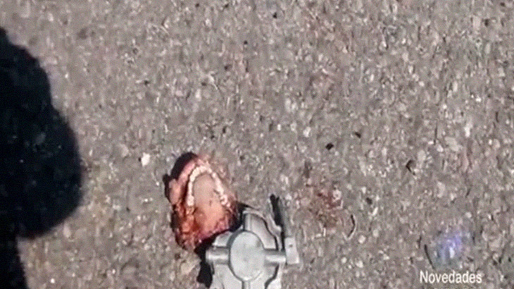 【閲覧注意】この事故現場、”下顎だけ” が地面に転がってるんだけど･･･。