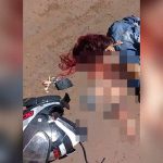 【閲覧注意】バイクに乗っていた女性、転倒して顔を地面に強打してグチャグチャに･･･。