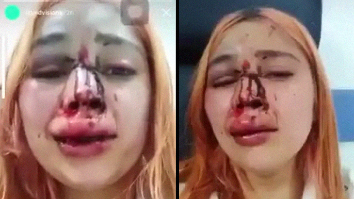 警察官に顔を破壊されてしまった女の子･･･。