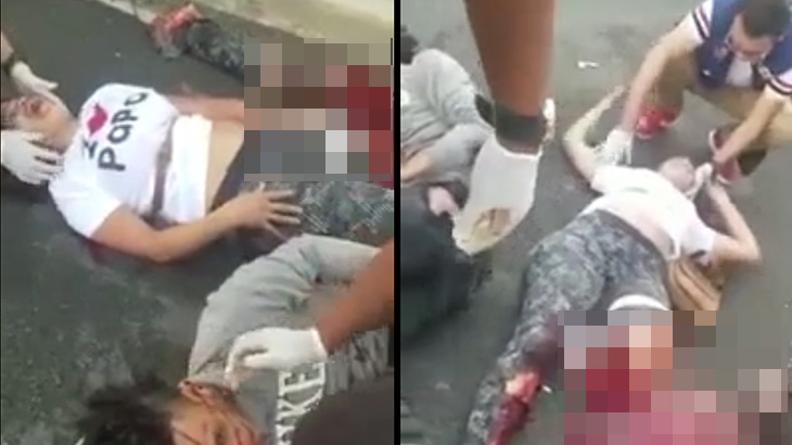 【閲覧注意】事故により左脚を切断されてしまった女性。