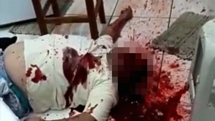 【閲覧注意】ショットガンで “顔に大きな穴” を開けられて死んだ男性。