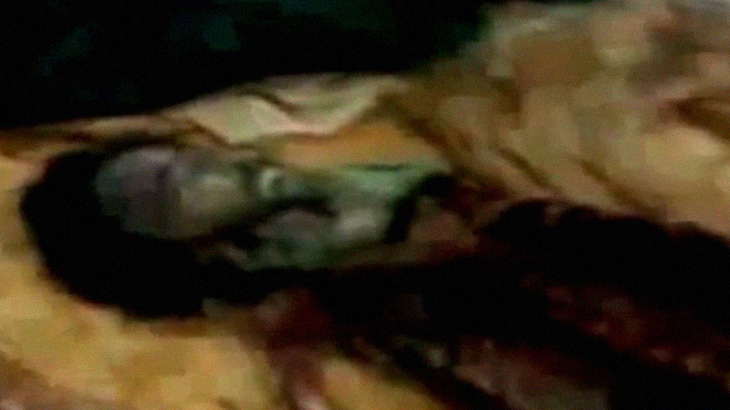 【閲覧注意】野生動物に身体の肉を “ほとんど食われた” 男性の死体･･･。